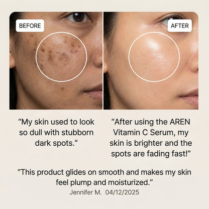Vitamin C Serum - Radiance Complex
